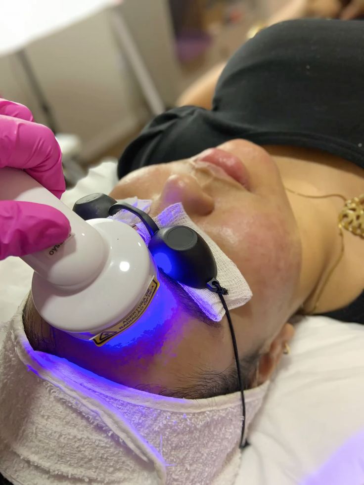 Fotobiomodulação Facial