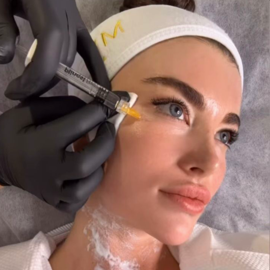 Preenchimento de Olheiras