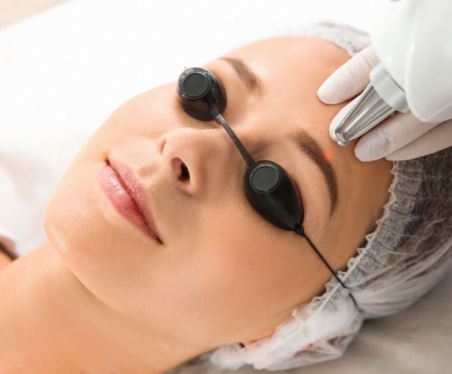 Remoção de Micropigmentação