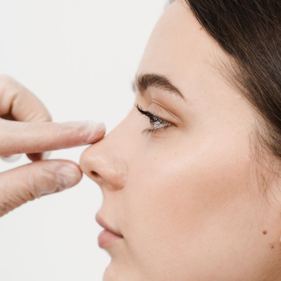 Rinomodelação com Fios de PDO