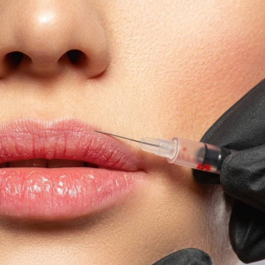 Preenchimento Labial