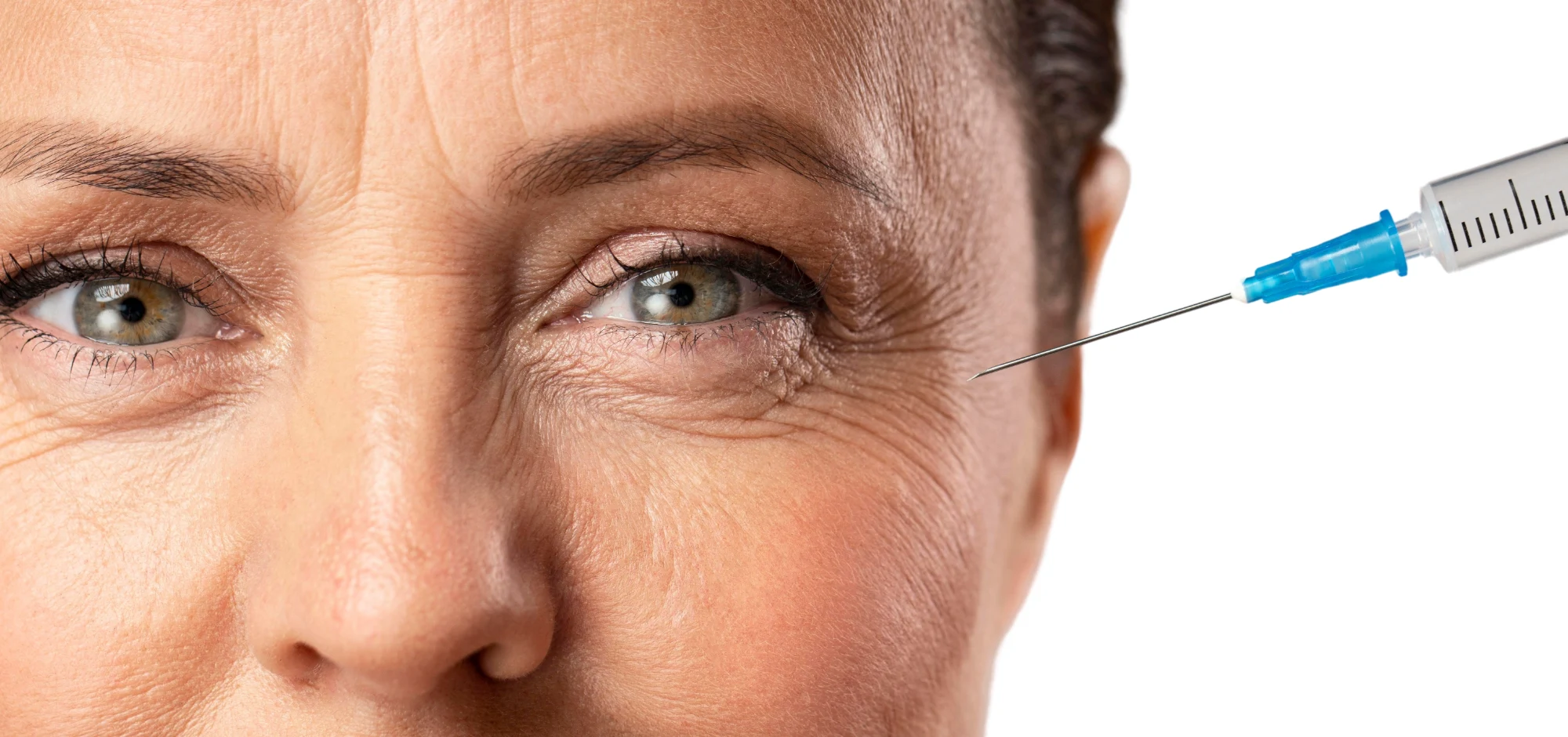 Mulher em atendimento de Botox em Rio do Sul com foco em resultado natural