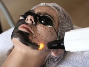 Peeling de Hollywood rio do sul