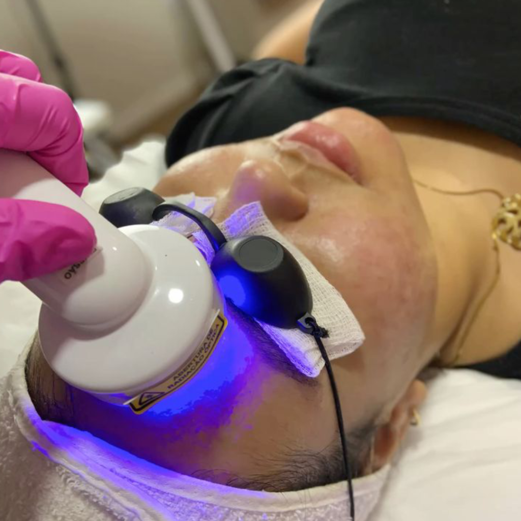 Fotobiomodulação Facial rio do sul