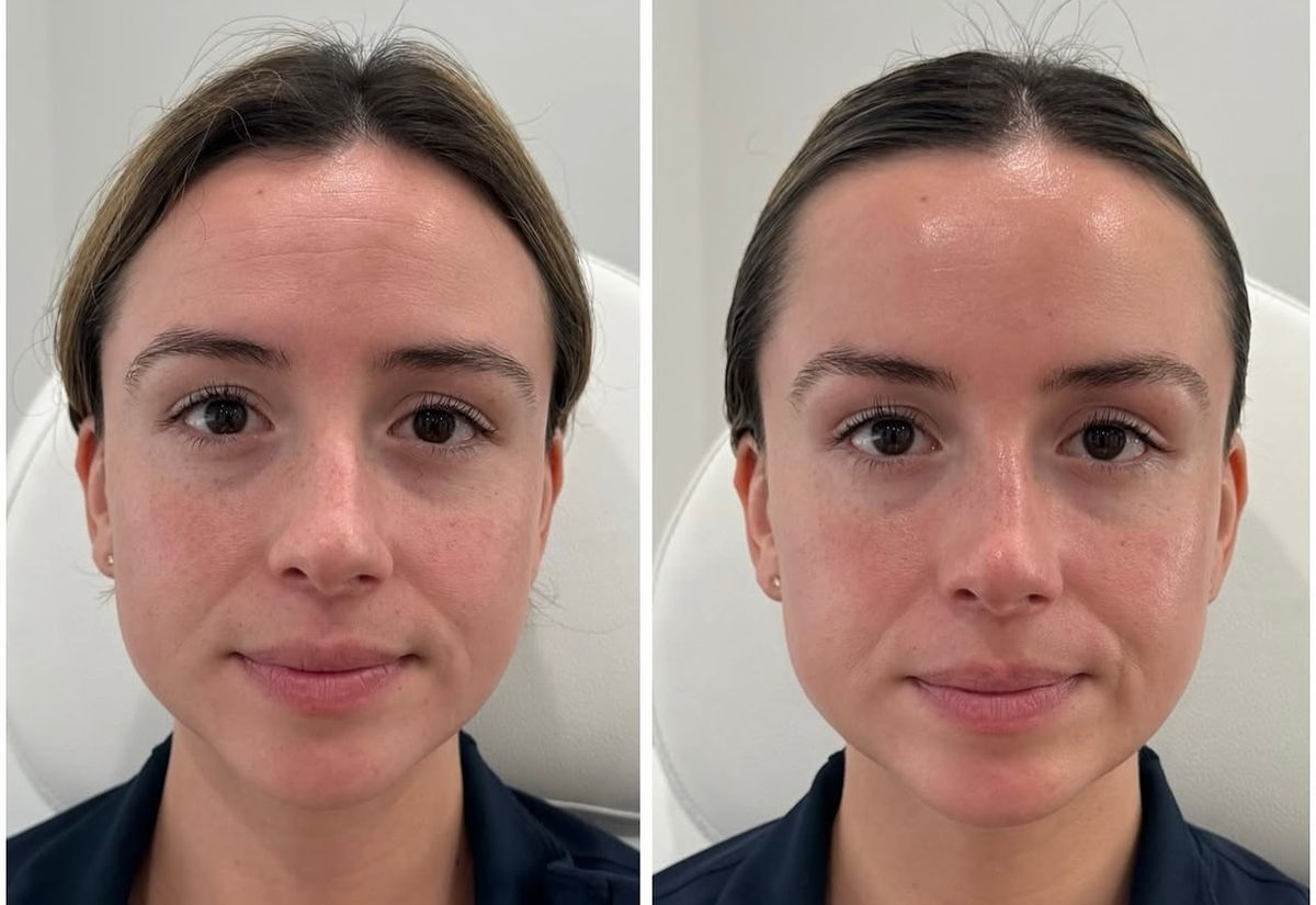 Pelling de Hollywood, antes e depois.